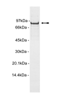 Q02156, PRKCE, MGC125656, PKCE, MGC125657, nPKC-epsilon, kinase